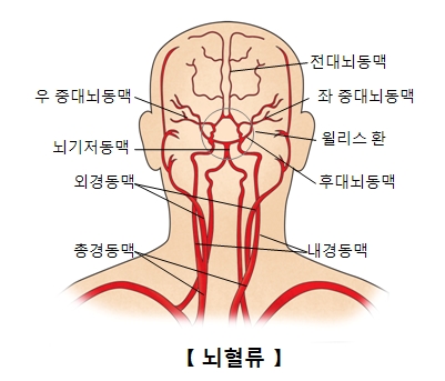척추 뇌저 동맥 증후군
